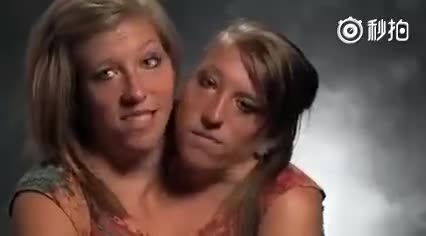 双头人美女，这到底谁说了算呢